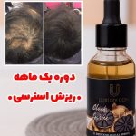 سرم فرانسوی ریزش مو