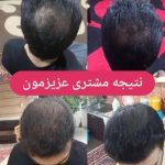 رفع تموم مشکلات پوست ومو درکمترین زمان