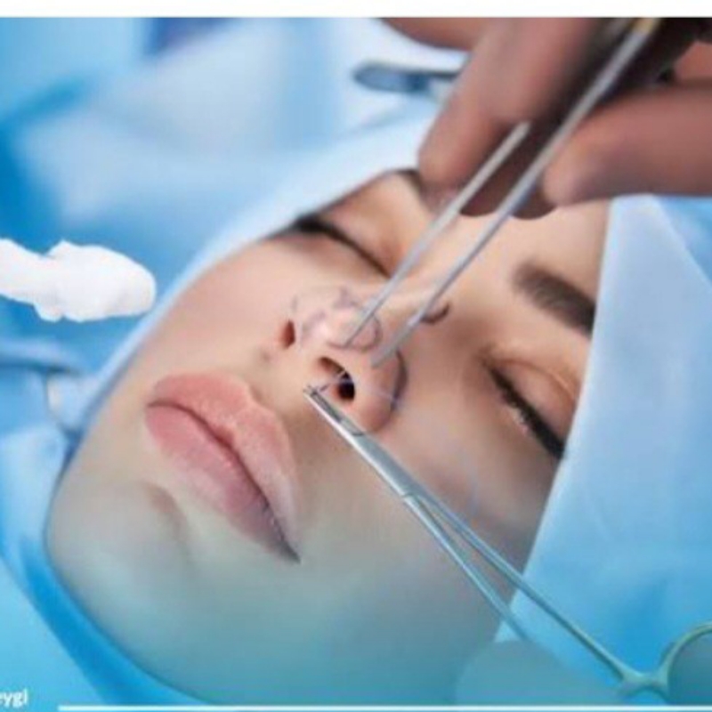 انجام کلیه مراحل بستری عمل زیبایی