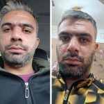 رفع تموم مشکلات پوست ومو درکمترین زمان