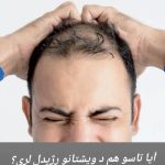 متخصص و مشاور مو و ریش