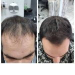 متخصص و مشاور مو و ریش