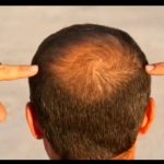 متخصص و مشاور مو و ریش